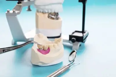 Керамические вкладки можно устанавливать как на передние, так и на жевательные зубы.