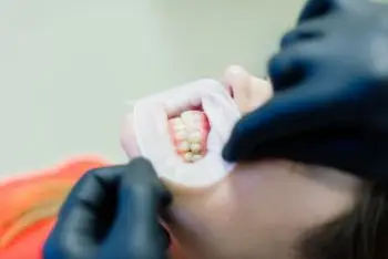 Лечение подвижных зубов