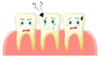 10 причин не откладывать лечение кариозных зубов