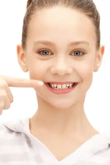 Специфика лечения молочных зубов