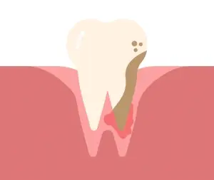 Деформация зубов