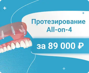 All-on-4/6 - Протезирование All-on-4 за 89 000 ₽